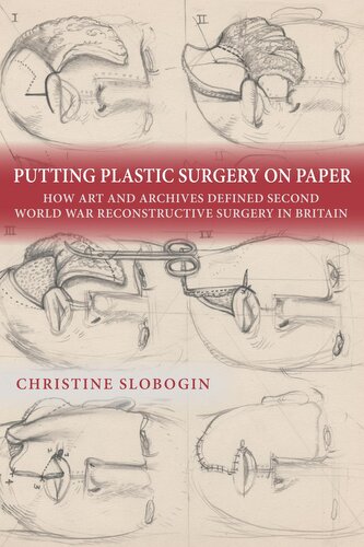 Putting Plastic Surgery on Paper