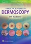 Markowitz, O: Practical Guide to Dermoscopy