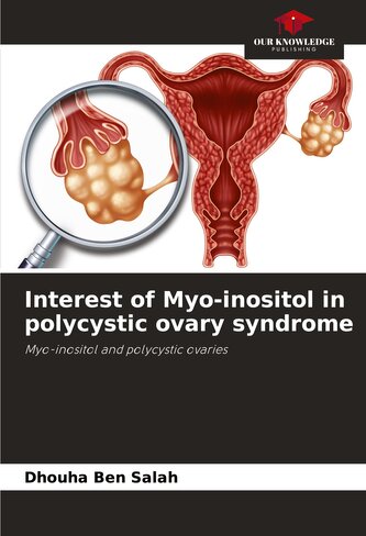 Interest of Myo-inositol in polycystic ovary syndrome
