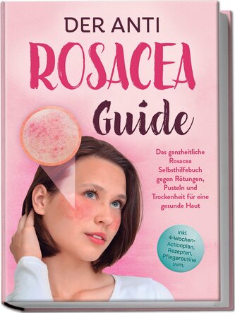 Der Anti Rosacea Guide: Das ganzheitliche Rosacea Selbsthilfebuch gegen Rötungen, Pusteln und Trockenheit für eine gesunde Haut