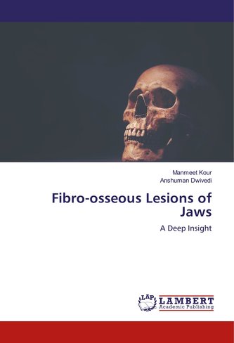 Fibro-osseous Lesions of Jaws