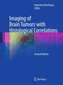 Imaging of Brain Tumors with Histological Correlations