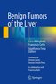 Benign Tumors of the Liver