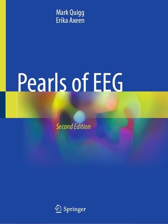 Pearls of EEG