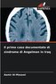 Il primo caso documentato di sindrome di Angelman in Iraq