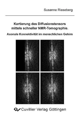 Kartierung des Diffusionstensors mittels schneller NMR-Tomographie
