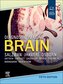 Diagnostic Imaging: Brain,