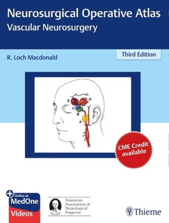 Neurosurgical Operative Atlas: Vascular Neurosurgery Neurosurgical Operative Atlas: Vascular Neurosurgery