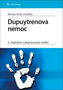 Dupuytrenova nemoc