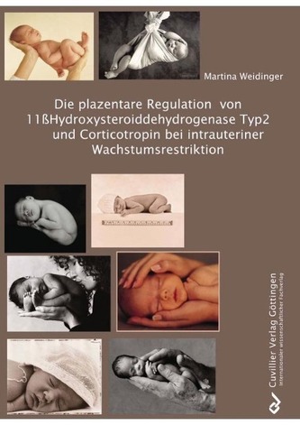 Die plazentare Regulation von 11ßHydroxysteroiddehydrogenase Typ2 und Corticotropin bei intrauteriner Wachstumsrestriktion