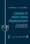 Update in Heart Valve Replacement