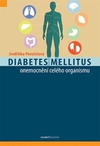 Diabetes mellitus - onemocnění celého organismu Diabetes mellitus - onemocnění celého organismu