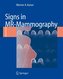 Signs in MR-Mammography