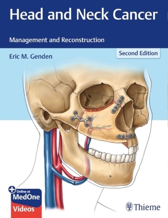 Head and Neck Cancer Head and Neck Cancer