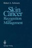 Skin Cancer