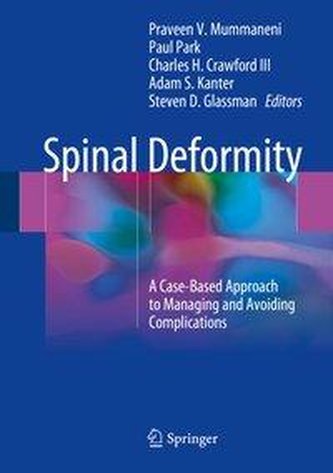 Spinal Deformity