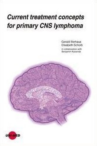 Current treatment concepts for primary CNS lymphoma