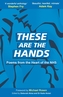 These Are The Hands
