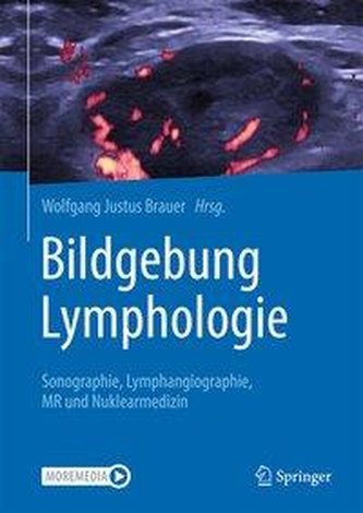 Bildgebung Lymphologie