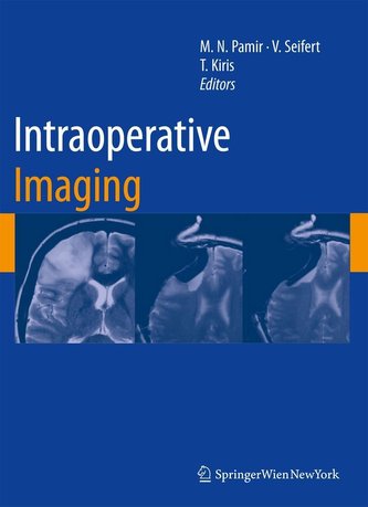 Intraoperative Imaging