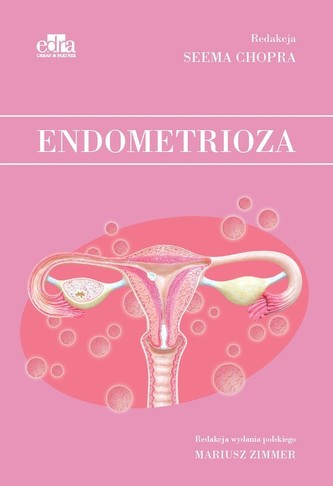 Endometrioza