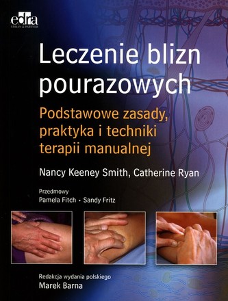 Leczenie blizn Podstawy teoretyczne i techniki terapeutyczne
