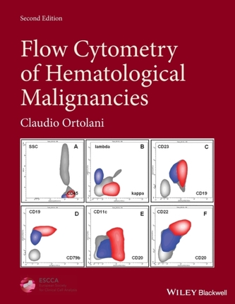 Flow Cytometry of Hematological Malignancies