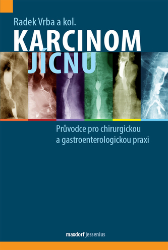 Karcinom jícnu - Průvodce pro chirurgickou a gastroenterologickou praxi