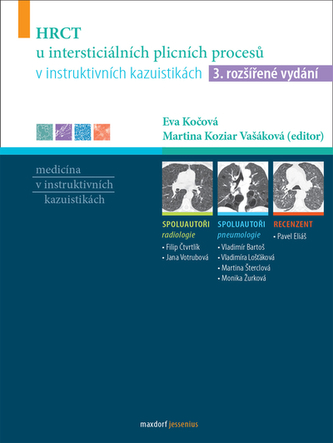 HRCT u intersticiálních plicních procesů v instruktivních kazuistikách HRCT u intersticiálních plicních procesů v instruktivních kazuistikách