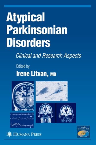 Atypical Parkinsonian Disorders: Clinical and Research Aspects