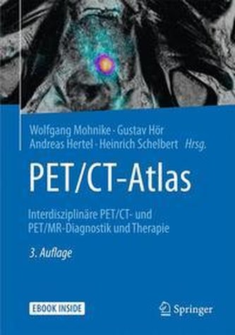 PET/CT-Atlas