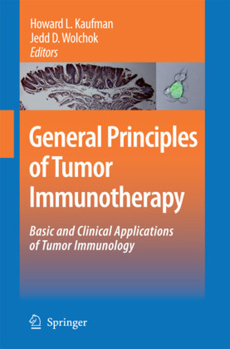 General Principles of Tumor Immunotherapy