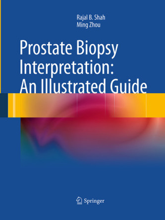Prostate Biopsy Interpretation: An Illustrated Guide
