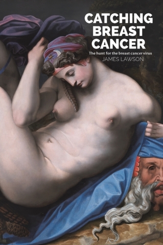 CATCHING BREAST CANCER