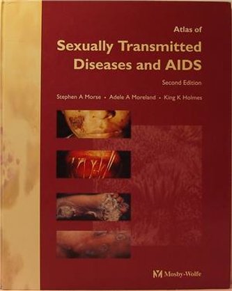 Atlas of Sexuality Transmitted Dis