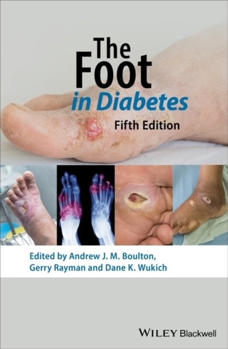 The Foot in Diabetes 5th Edition