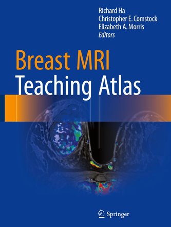 Breast MRI Teaching Atlas