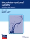 Neurointerventional Surgery