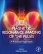 Magnetic Resonance Imaging of The Pelvis