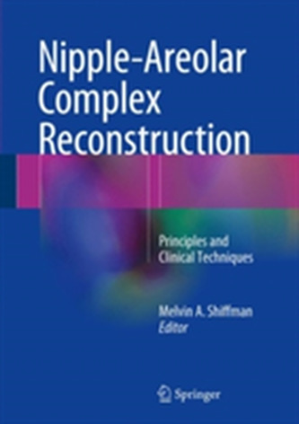 Nipple-Areolar Complex Reconstruction