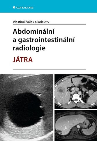 Abdominální a gastrointestinální radiologie - Játra Abdominální a gastrointestinální radiologie - Játra