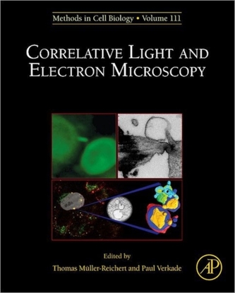 Correlative Light and Electron MIcroscopy