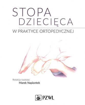 Stopa dziecięca w praktyce ortopedycznej