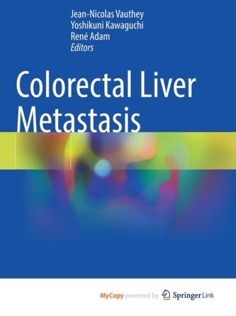 Colorectal Liver Metastasis
