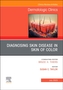Diagnosing Skin Disease in Skin of Color, An Issue of Dermatologic Clinics