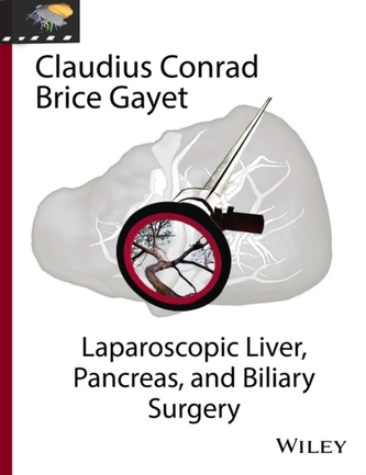 Laparoscopic Liver, Pancreas, and Biliary Surgery