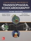 Clinical Manual and Review of Transesophageal Echocardiography, 3/e