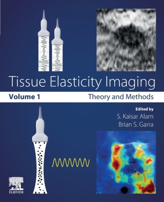 Tissue Elasticity Imaging