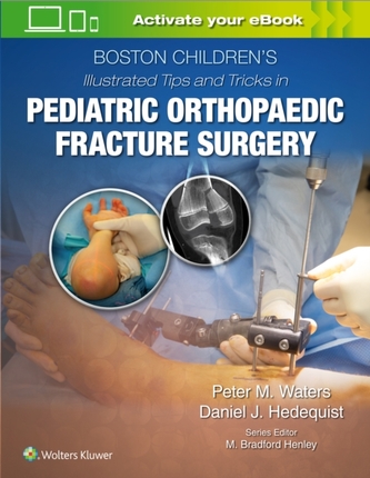 Boston Children's Illustrated Tips and Tricks  in Pediatric Orthopaedic Fracture Surgery