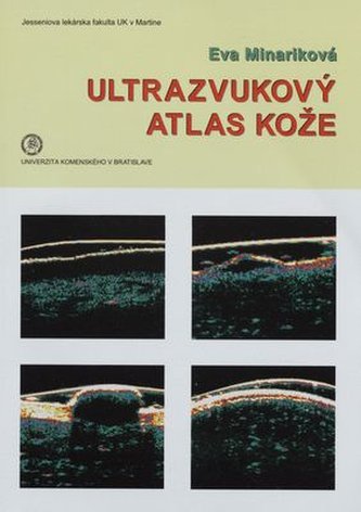Ultrazvukový atlas kože
